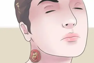 Ilustración de un hombre con un nacido en el cuello